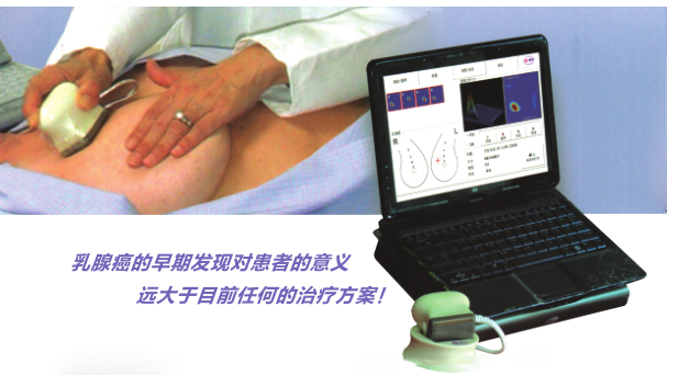 乳腺触诊成像系统